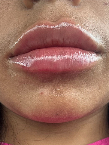 5a4ec69e-1024-4280-b41e-26929374a8d2 1